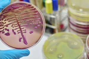 Se trataba de una bacteria "pan-drogo resistente". Créditos: Télam