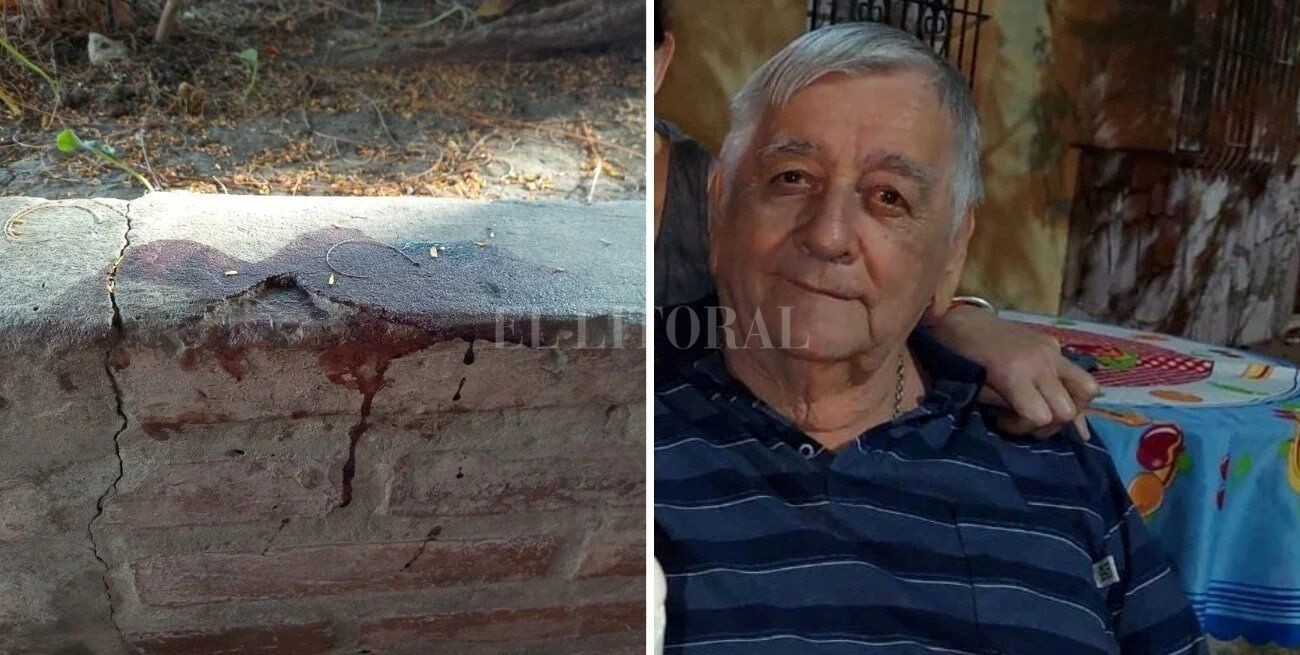 Oscar, un jubilado de 73 años, permanece hospitalizado tras el ataque. Crédito: El Litoral