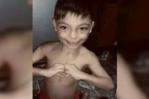 Mateo Benegas, el niño de 7 años que espera viajar a Buenos Aires para ser intervenido quirúrgicamente.