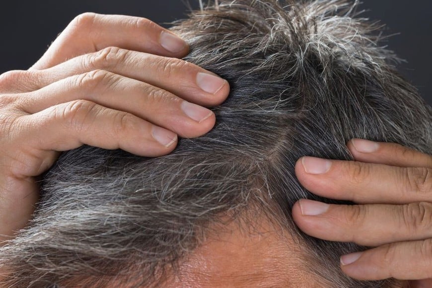 Las primeras canas suelen aparecer entre los 30 y 50 años.