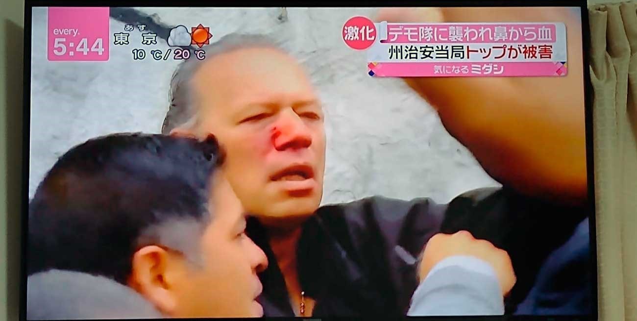 La piña a Berni llegó a la TV de Japón y explotan las redes sociales
