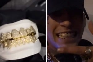 Se viralizaron los nuevos "dientes" del cantante.