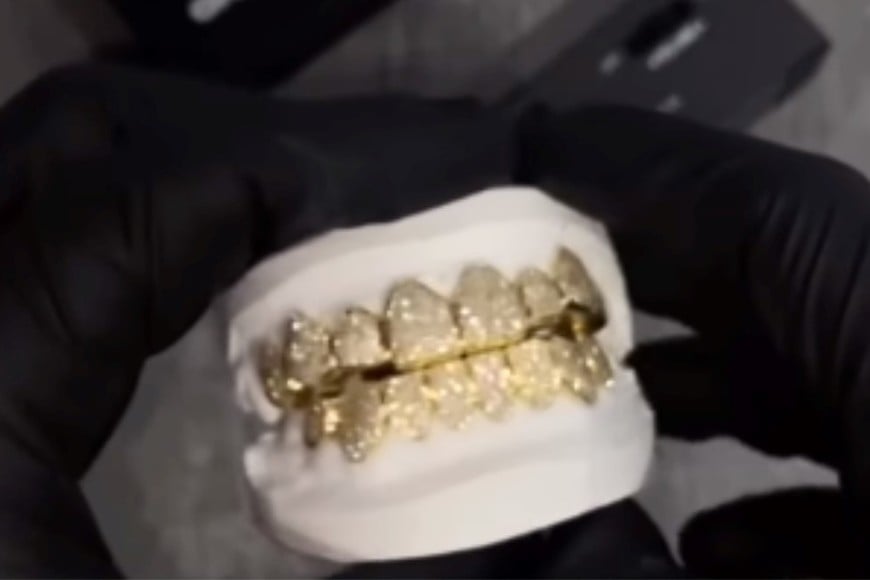 La dentadura postiza de L-Gante en detalle.