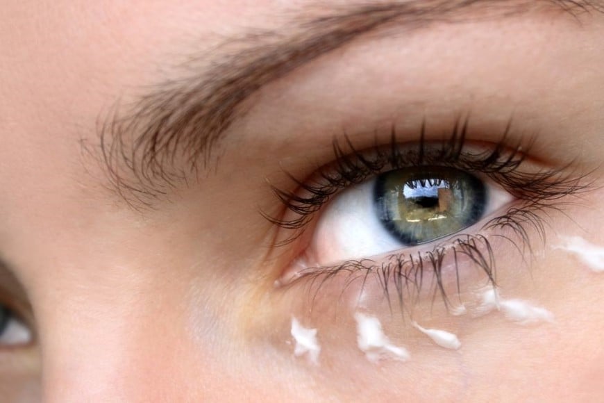 Las cremas para el contorno de los ojos son una opción de tratamiento.