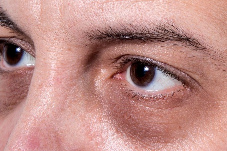 Se presentan en diferentes colores, desde marrón oscuro hasta azul o violeta.