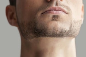 Esta técnica fortalece los músculos faciales y realinea la mandíbula.