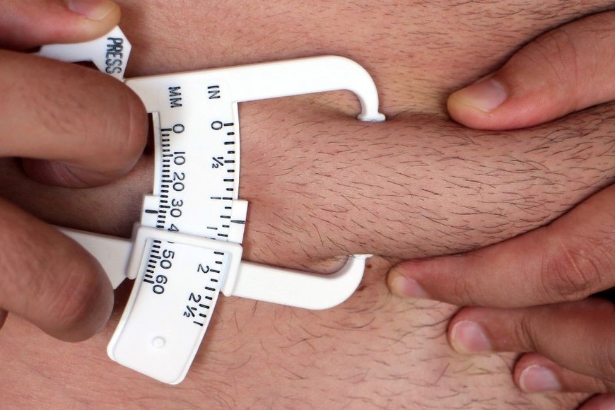 Exceso de adiposidad en personas con un peso considerado normal