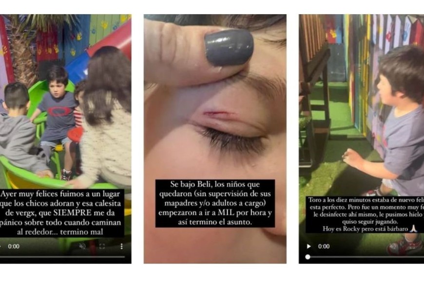 El descargo de Juana Repetto luego de que su hijo se accidentara en una calesita.