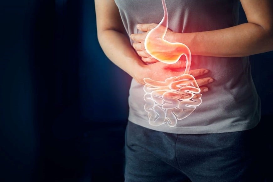 Los síntomas pueden ser similares a otros trastornos intestinales.
