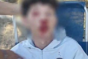 Los adolescentes resultaron gravemente heridos