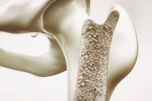 Según el Dr. Grin, la etapa crucial para la salud ósea se encuentra en los primeros 35 años de vida