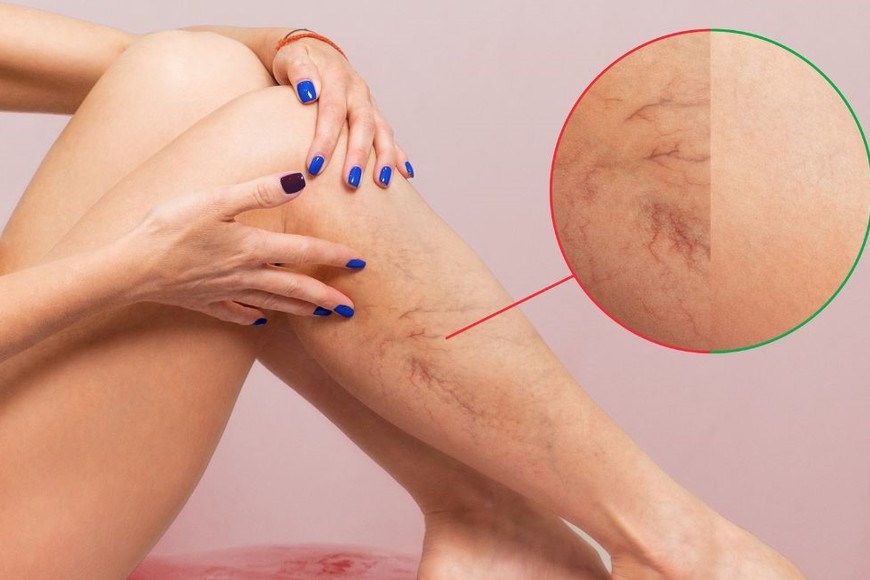 Esta afección es la causante de 1 de cada 4 fallecimientos en el mundo.