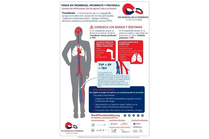 Signos y síntomas de la trombosis