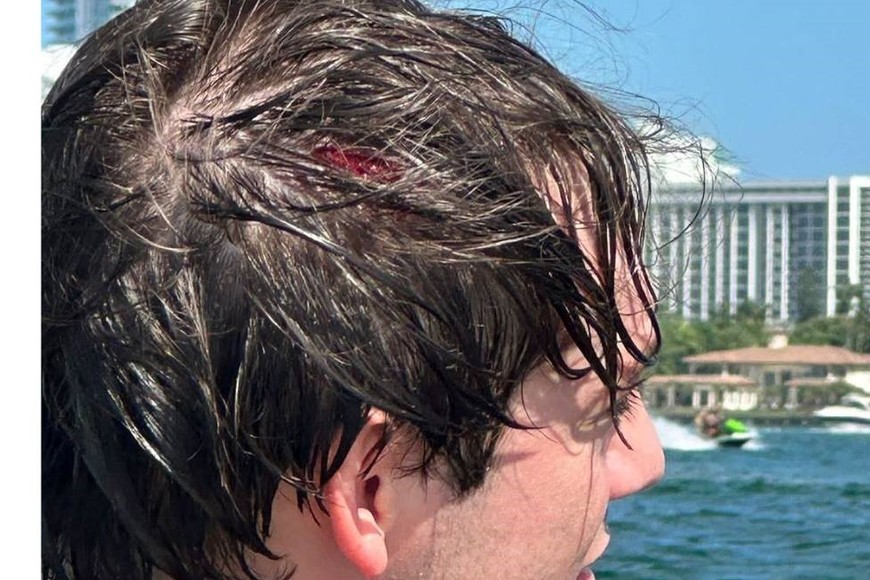 Paulo Londra se accidentó mientras manejaba una moto de agua.