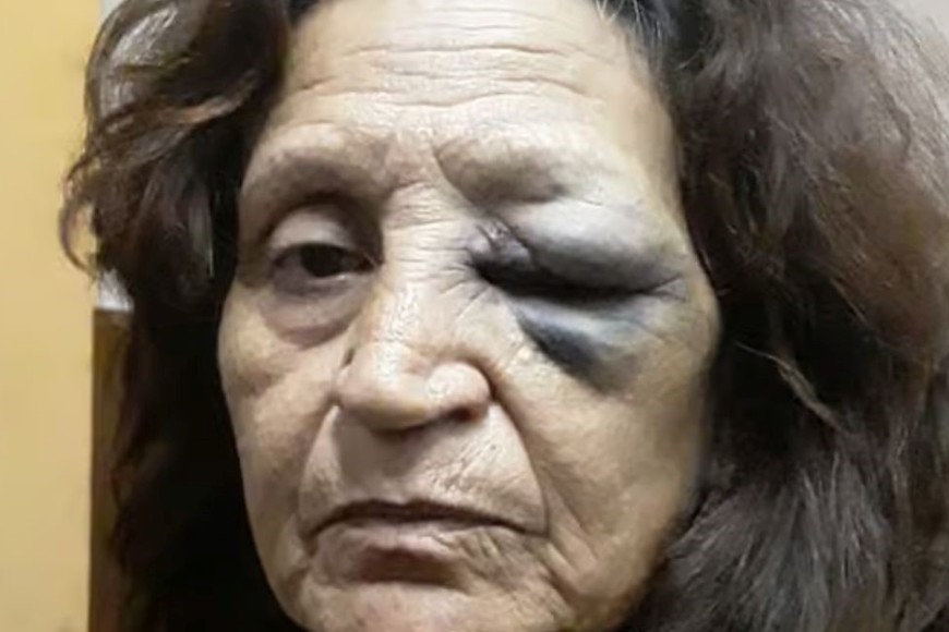 Una de las víctimas.