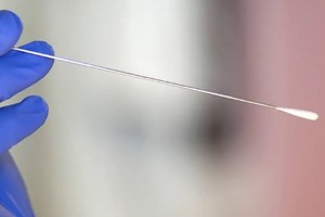 Los "obeliscos" se encuentran sobre todo en la boca.