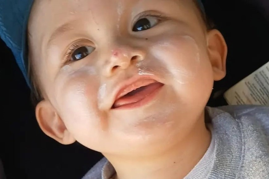 Tras nacer, a Luca le descubrieron una rara enfermedad que le imposibilitaba la exposición al sol y a determinadas luces. Foto: gentileza