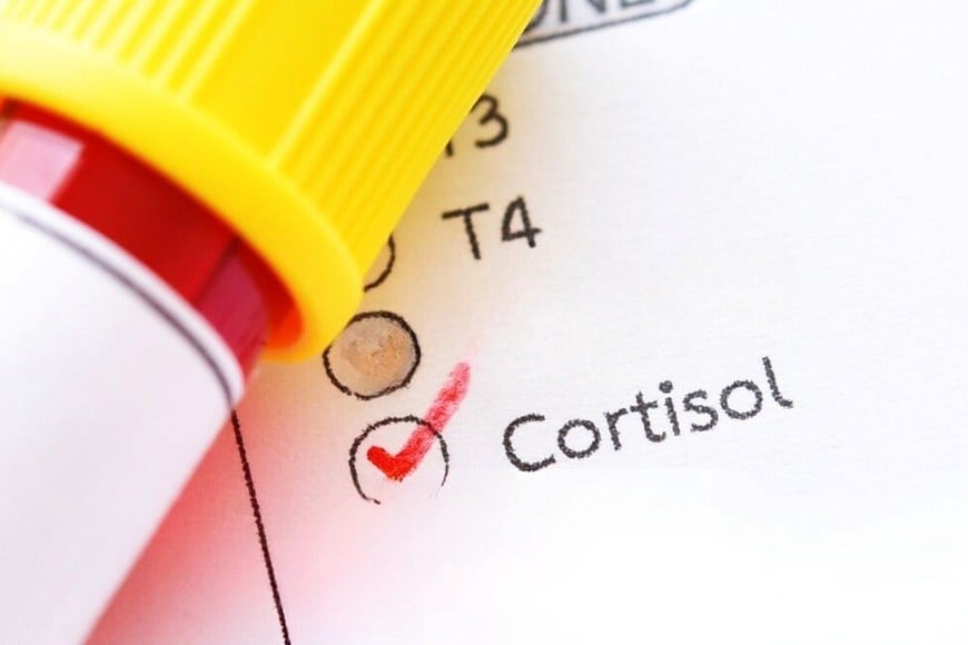 Los mitos y verdades sobre el cortisol.