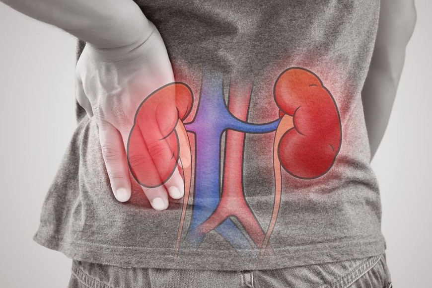 Los riñones desempeñan una función vital en nuestro cuerpo