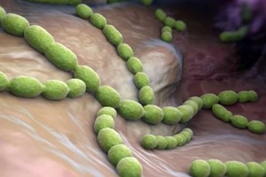 Las infecciones bacterianas agudas son causadas por estreptococos hemolíticos