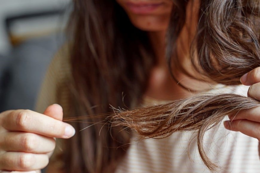 Otra razón común de la pérdida de cabello es el estrés emocional.