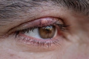 Pueden convertirse en una verdadera molestia si no se abordan adecuadamente.