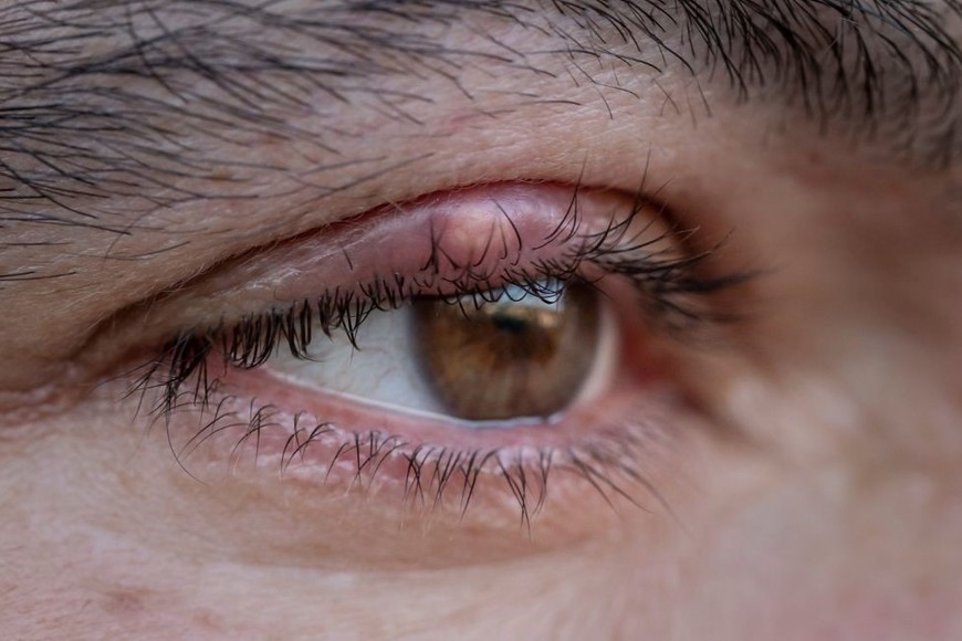 Pueden convertirse en una verdadera molestia si no se abordan adecuadamente.