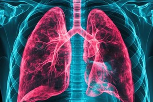 Se están promoviendo medidas de prevención, detección temprana y manejo clínico adecuado de la enfermedad, así como su investigación, prevención y control.