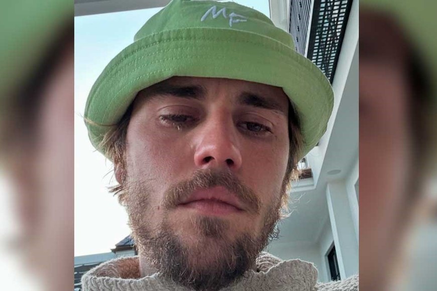 Una de la fotos que subió Justin y preocupó a sus seguidores.