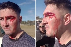 El árbitro fue agredido con un golpe de puño a la altura del pómulo izquierdo.