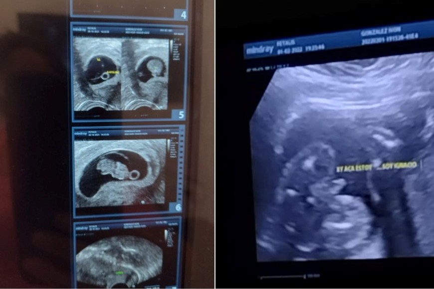 Con la fecundación in vitro, Ivón y Sergio obtuvieron la respuesta más esperada.