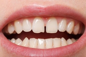 Investigación pionera. Científicos de la Universidad de Kyoto trabajan en el laboratorio para desarrollar el medicamento que podría regenerar dientes perdidos en adultos.