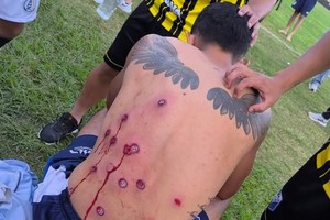 Así quedó uno de los jugadores de Talleres de Perico.