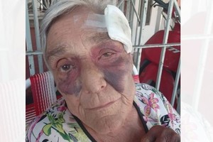 La mujer sufrió graves lesiones a raíz de los golpes.