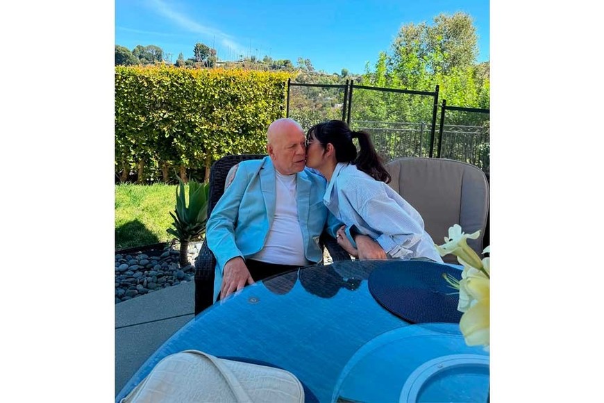 El actor fue diagnosticado con afasia.