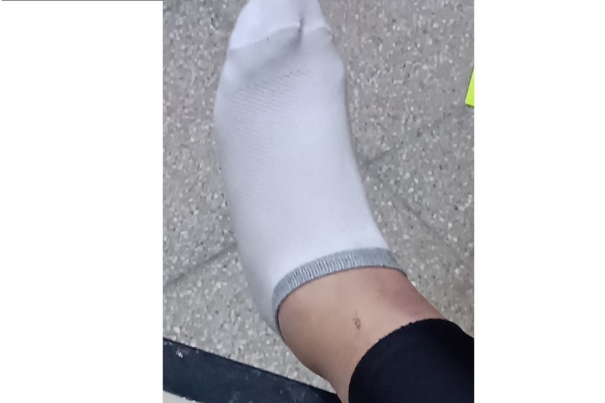 La mujer deberá ser sometida a una cirugía en las próximas horas