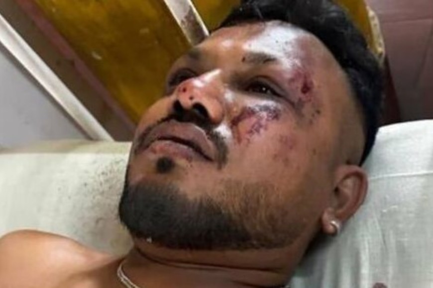 Ramesh Vishwaskumar está siendo tratado en el hospital.