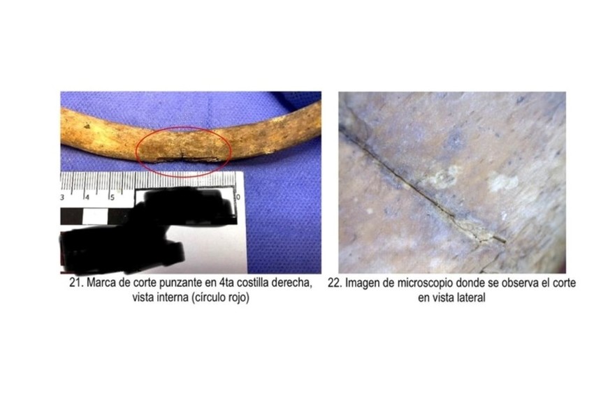 Los profundos cortes que tenian los huesos. Foto: Gentileza