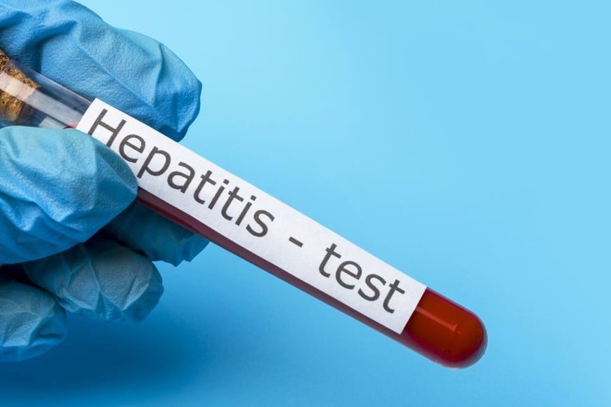 Se notificaron 69 casos confirmados