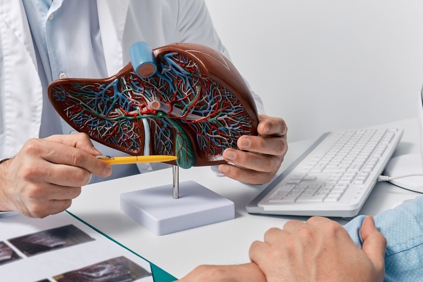 La hepatitis A es una enfermedad viral que afecta al hígado