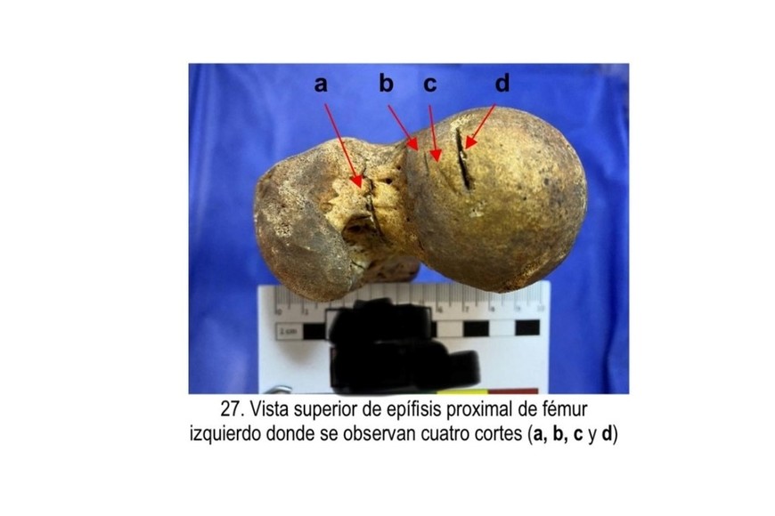 Los profundos cortes que tenian los huesos. Foto: Gentileza