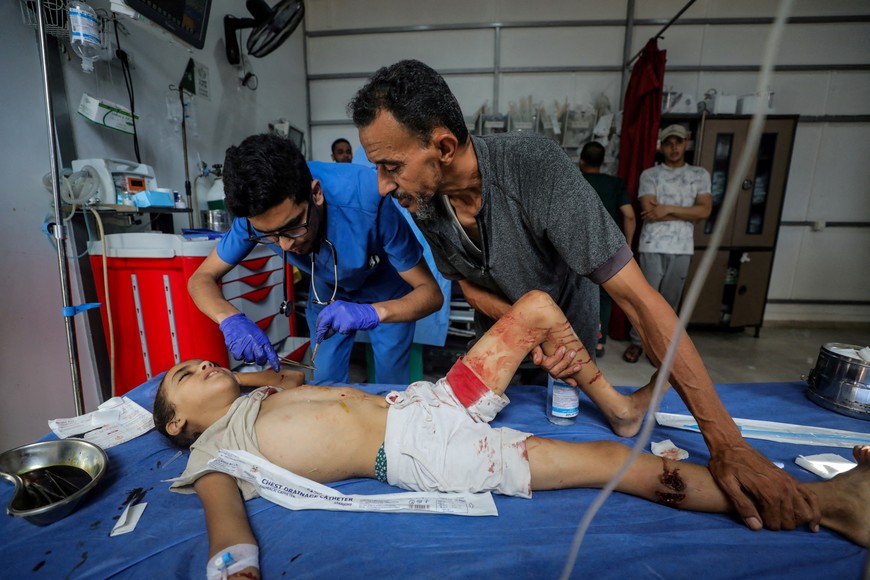 SENSITIVE MATERIAL. THIS IMAGE MAY OFFEND OR DISTURB A Palestinian child, wounded in an Israeli strike that killed people, who gathered to collect water from a distribution point, according to medics, receives treatment at Al-Awda Hospital in Nuseirat in the central Gaza Strip July 13, 2025. REUTERS/Stringer      TPX IMAGES OF THE DAY