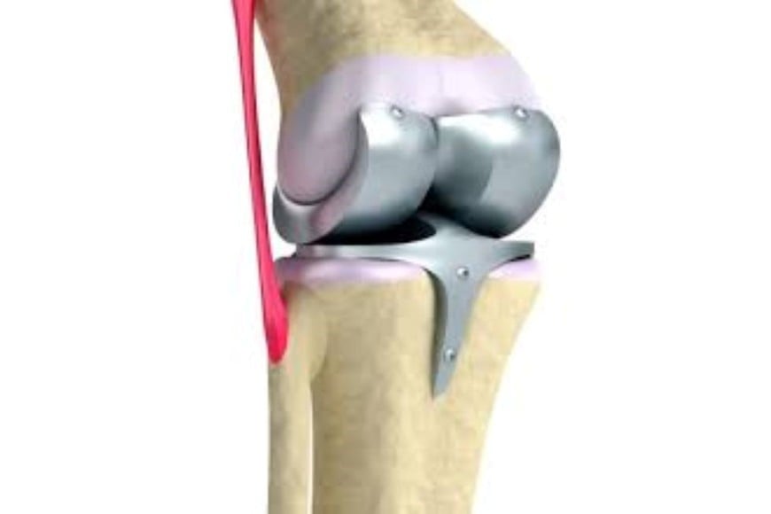 Biovand Group SRL fue sancionada luego de una denuncia realizada por la Cámara de la Industria Traumatológica
