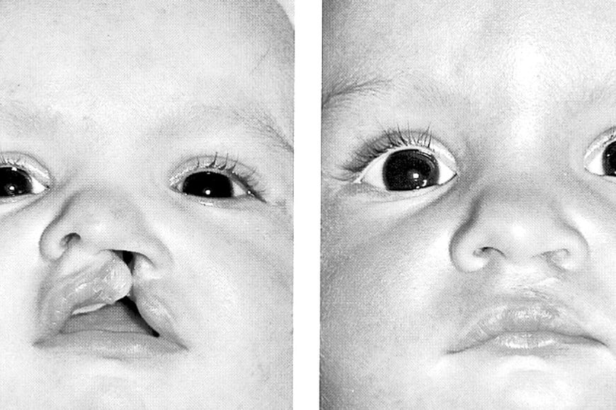 Hay cosas que no pueden ser baratas, sino que necesitan presupuesto. Imagen ilustrativa. Gentileza.