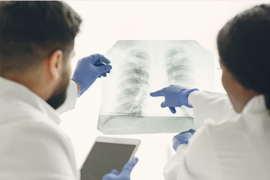 La legionelosis es un tipo de neumonía o infección pulmonar.