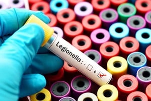 Los brotes suelen ocurrir en sistemas de agua grandes y complejos como hoteles, hospitales y cruceros.