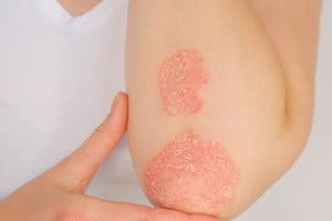 La atención médica se realizará del 18 al 22 de agosto