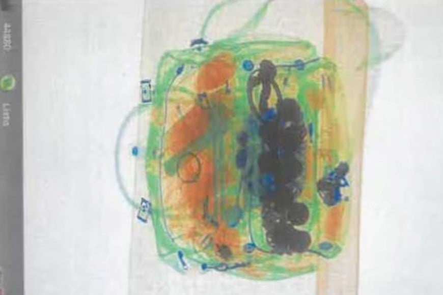 La imagen que mostró el escáner