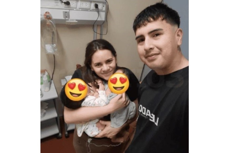 Las siamesas antes de ser separadas