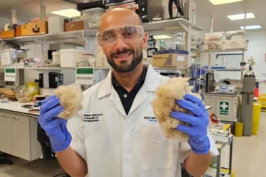 Para el estudio, usaron queratina extraída de lana de oveja.